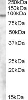 TCHHL1 Antibody in Western Blot (WB)