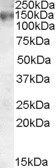 MRP1 Antibody in Western Blot (WB)