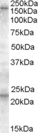 SUR1 Antibody in Western Blot (WB)