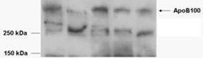 Apolipoprotein B Antibody in Western Blot (WB)