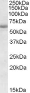 CDH23 Antibody in Western Blot (WB)