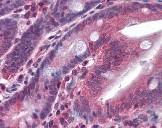 Monoacylglycerol Lipase Antibody in Immunohistochemistry (Paraffin) (IHC (P))