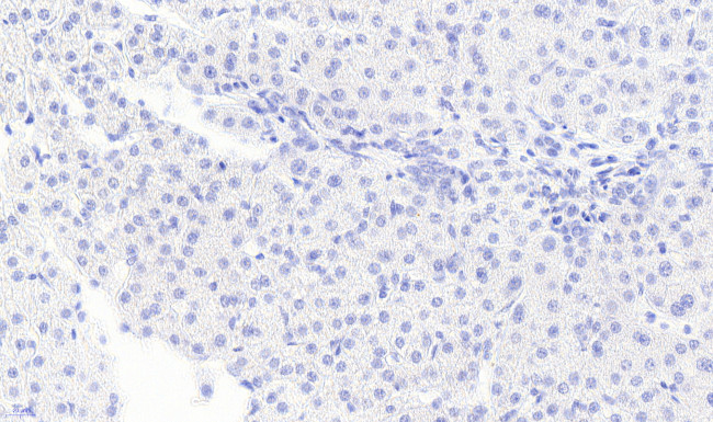 Monoacylglycerol Lipase Antibody in Immunohistochemistry (Paraffin) (IHC (P))