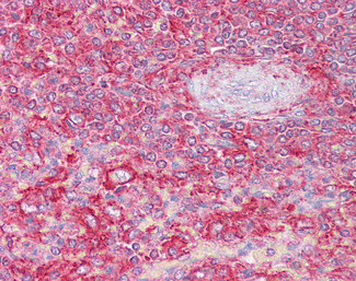 Clathrin Light Chain Antibody in Immunohistochemistry (Paraffin) (IHC (P))