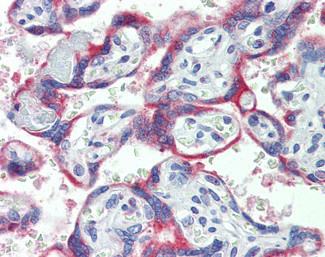 NOX2 Antibody in Immunohistochemistry (Paraffin) (IHC (P))