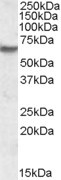 IMPDH2 Antibody in Western Blot (WB)