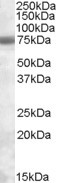 PMSCL1 Antibody in Western Blot (WB)