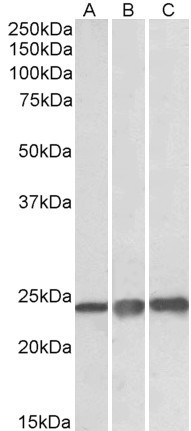 PRDX1 Antibody in Western Blot (WB)