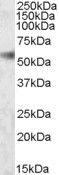 SH2D4A Antibody in Western Blot (WB)