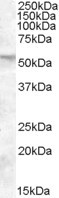 FKBP4 Antibody in Western Blot (WB)