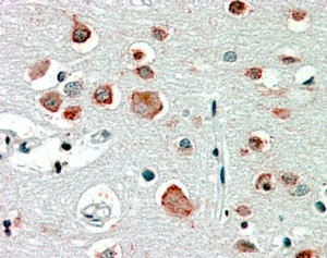 GABRA4 Antibody in Immunohistochemistry (Paraffin) (IHC (P))