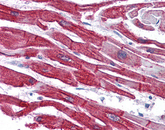 Desmin Antibody in Immunohistochemistry (Paraffin) (IHC (P))