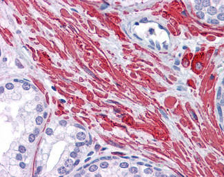 Desmin Antibody in Immunohistochemistry (Paraffin) (IHC (P))