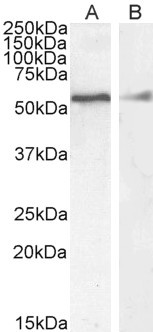 Desmin Antibody in Western Blot (WB)