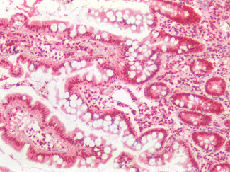 TDP-43 Antibody in Immunohistochemistry (Paraffin) (IHC (P))