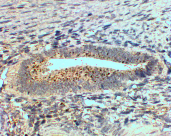 SFRP4 Antibody in Immunohistochemistry (Paraffin) (IHC (P))