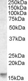 NOXA Antibody in Western Blot (WB)