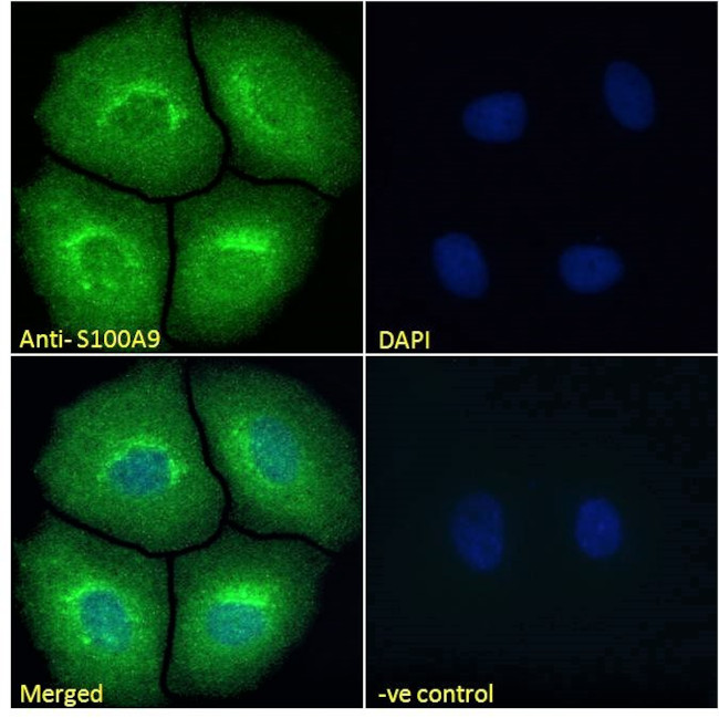 S100A9 Antibody in Immunocytochemistry (ICC/IF)