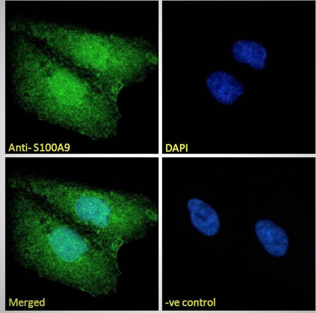 S100A9 Antibody in Immunocytochemistry (ICC/IF)