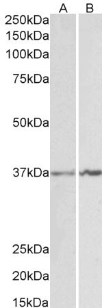 Annexin A1 Antibody in Western Blot (WB)