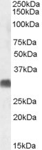 SRD5A2 Antibody in Western Blot (WB)