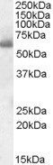 SH2D3A Antibody in Western Blot (WB)