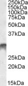 DLX5 Antibody in Western Blot (WB)