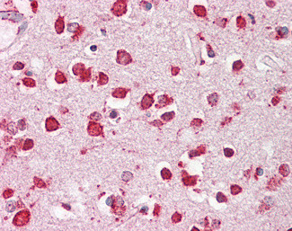 LIMP2 Antibody in Immunohistochemistry (Paraffin) (IHC (P))