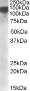 DHX9 Antibody in Western Blot (WB)