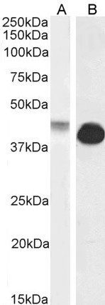 Connexin 43 Antibody in Western Blot (WB)