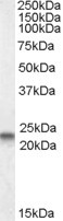 Caveolin 3 Antibody in Western Blot (WB)