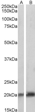 Caveolin 3 Antibody in Western Blot (WB)