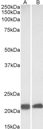 Caveolin 3 Antibody in Western Blot (WB)