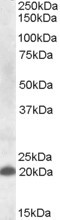 CLEC4C Antibody in Western Blot (WB)