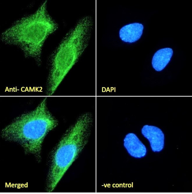 CaMKII alpha Antibody in Immunocytochemistry (ICC/IF)