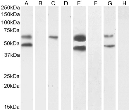 CaMKII alpha Antibody in Western Blot (WB)