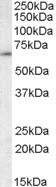 TCP-1 gamma Antibody in Western Blot (WB)