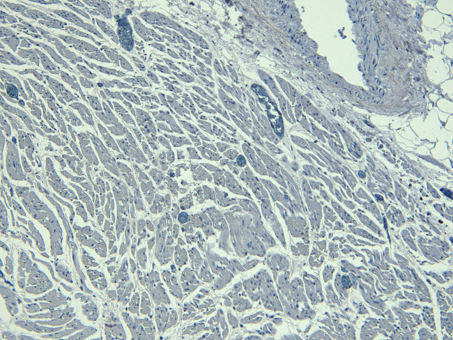 Nkx2.5 Antibody in Immunohistochemistry (Paraffin) (IHC (P))