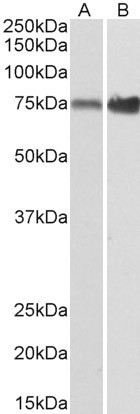 XPNPEP1 Antibody in Western Blot (WB)