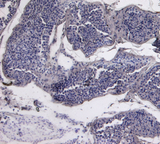 STK39 Antibody in Immunohistochemistry (Paraffin) (IHC (P))