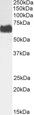 STK39 Antibody in Western Blot (WB)