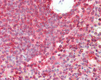 PSMB8 Antibody in Immunohistochemistry (Paraffin) (IHC (P))