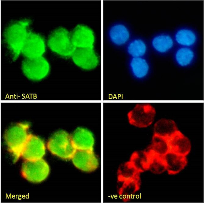 SATB1 Antibody in Immunocytochemistry (ICC/IF)