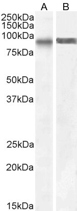 SATB1 Antibody in Western Blot (WB)