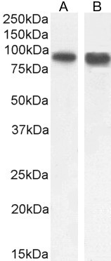 SATB1 Antibody in Western Blot (WB)