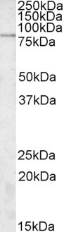 SGSM3 Antibody in Western Blot (WB)