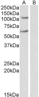 IREB2 Antibody in Western Blot (WB)