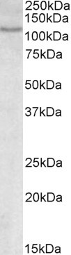 NFATC2 Antibody in Western Blot (WB)