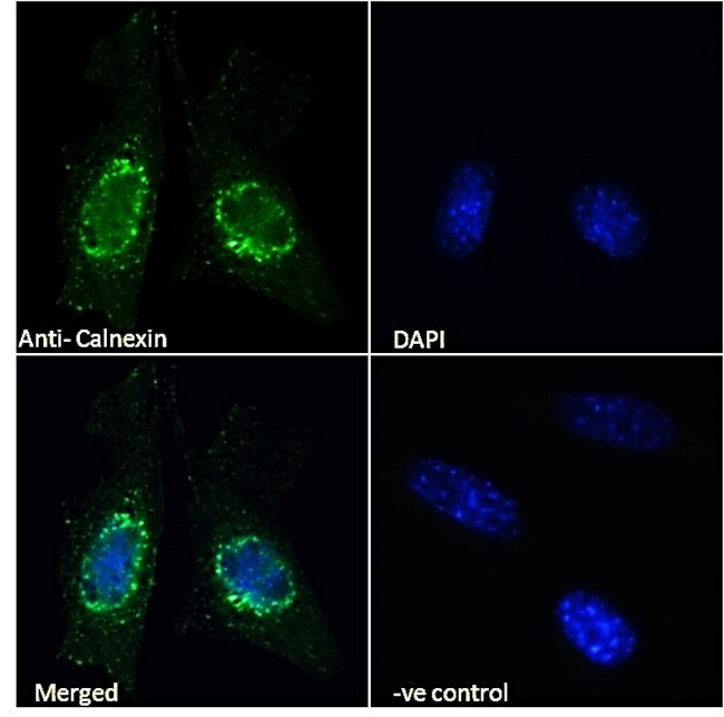 Calnexin Antibody in Immunocytochemistry (ICC/IF)