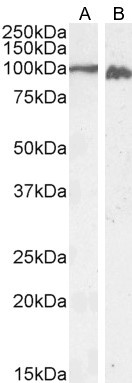 Calnexin Antibody in Western Blot (WB)